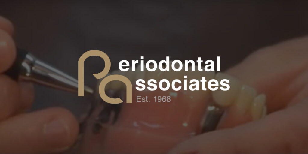 Dental Implants FAQ Periodontal Associates